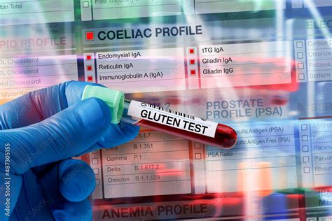 coeliac screen blood test bottle|coeliac test nhs uk.